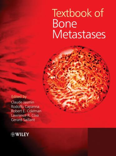 ISBN 9780471877424 product image for Textbook of Bone Metastases | upcitemdb.com
