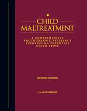 Child Maltreatment Child Maltreatment - Monteleone, James A. / Monteleone, J. a.